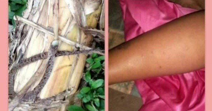 Minsa reporta 124 personas con mordeduras de serpientes en Chiriquí