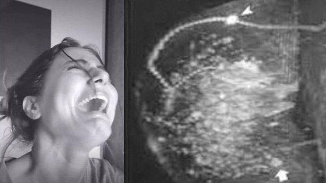 Hina Khan Breast Cancer News: Breast Cancer Surgery में पूरा स्तन हटाना पड़ता है क्या | Boldsky