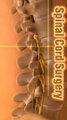 Spinal cord injury 3D animation shorts रीढ़ की हड्डी की चोट 3डी एनिमेशन शॉर्ट्स স্পাইনাল কর্ড ইনজুরি 3D অ্যানিমেশন শর্টস إصابة الحبل الشوكي شورت رسوم متحركة ثلاثي الأبعاد