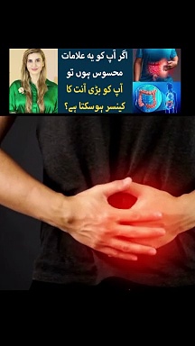 Symptoms of colon cancer || colon cancer disease