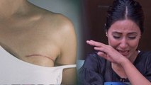 Hina Khan 3rd Stage B-reast Cancer: New Post में Body Scars को लेकर Emotional, निशान तो...|