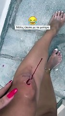 Ατύχημα για την Ιωάννα Τούνη στη Σύρο