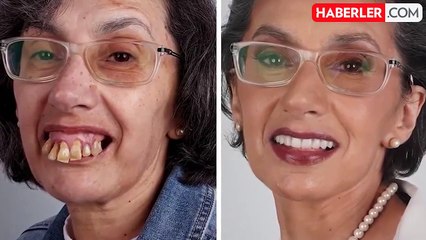 Gülmeyi bile bilmiyordu! Bambaşka birine dönüştü