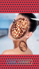 Women face & neck injury smooth removal | Asmr animation