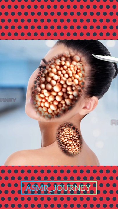 Women face & neck injury smooth removal | Asmr animation