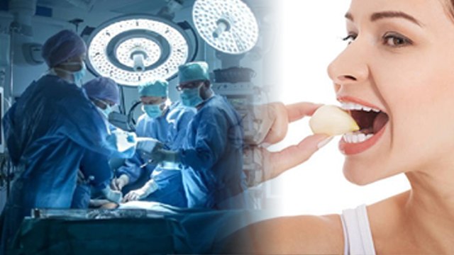सर्जरी होने से पहले लहसुन खाने से क्या होता है | Why Can't You Eat Garlic Before Surgery | Boldsky