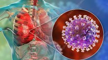 Nipah Virus Outbreak:What You need to know(2024)|Nipah Virus Infections |Nipah Virus Outbreak:What You need to know(2024)|Nipah Virus Infections |