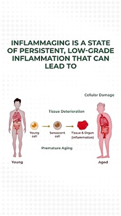 Break the cycle of inflammaging with these 5 powerful strategies! #advancells #health