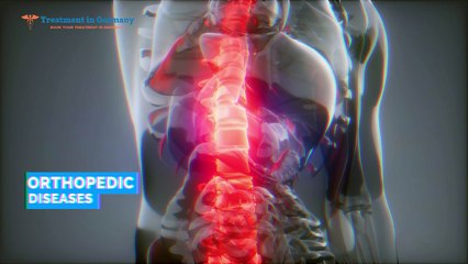 orthopedic disease symptoms