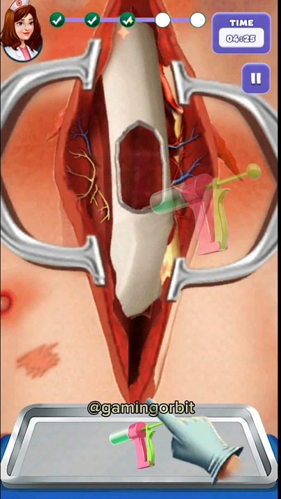Operate broken nose  ASMR #shorts #gamingorbit #asmrgaming
