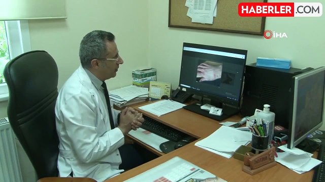 Uzmanlar uyarıyor: Mantar enfeksiyonlarında artış görüyoruz, tedaviye direnç söz konusu