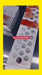 Blood Smear preparation.