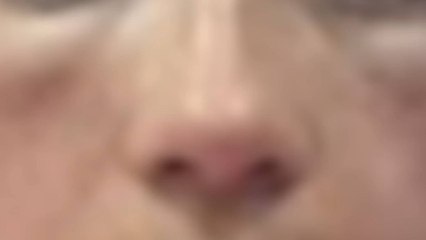 “Tengo bultos y me arde la vista”: mujeres denuncian haber sido estafadas por falsas esteticistas