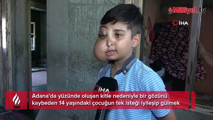 İki farklı yüzü var gibi görünen çocuğun tek isteği iyileşip gülmek