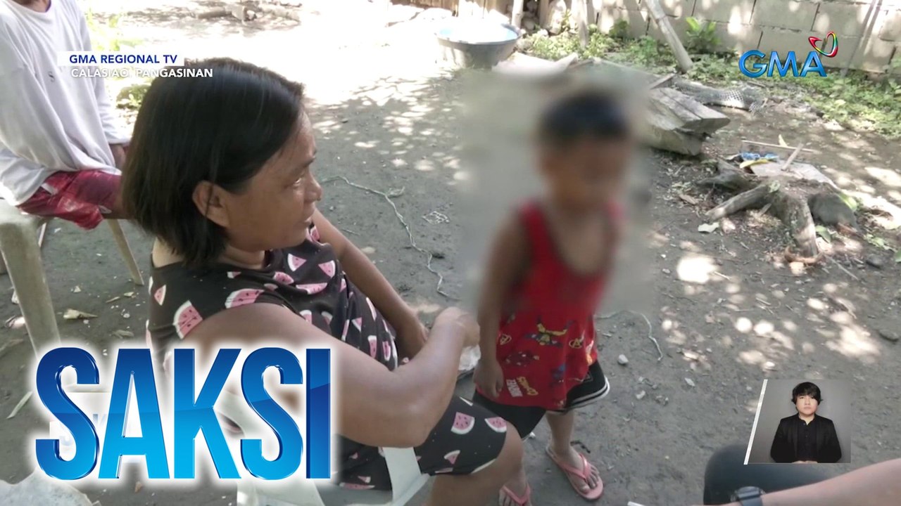 4-anyos na bata, sinakmal ng aso sa mukha | Saksi