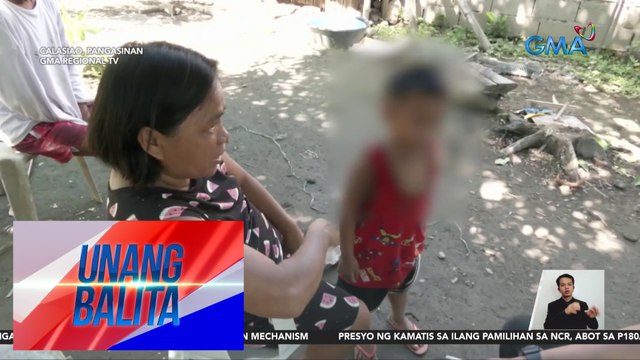 Bata, sinakmal ng aso sa mukha | Unang Balita