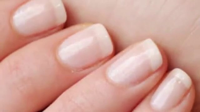 Brittle Nail Treatment deficiency of vitamins کمزور ناخن غذائیت اور وٹامن کی کمی