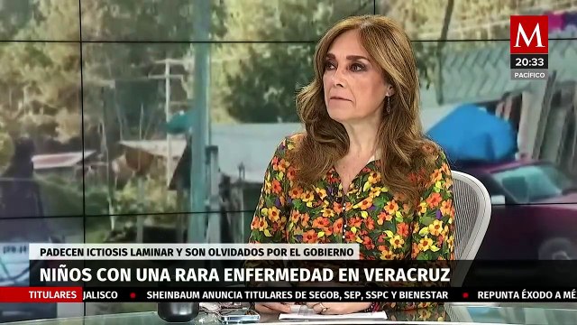 Lanzan exposición Los olvidados ; una rara enfermedad que padecen algunos habitantes de Veracruz