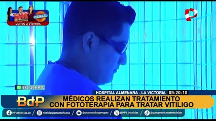 Nuevo tratamiento de fototerapia que puede reducir hasta en un 80% el vitiligo: ¿Dónde y cómo funciona?