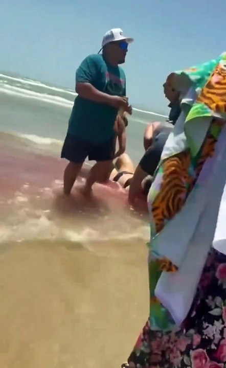 Mujer es atacada por un tiburón en la Isla del Padre, Texas