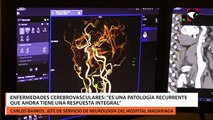 Enfermedades cerebrovasculares “Es una patología recurrente que ahora tiene una respuesta integral”