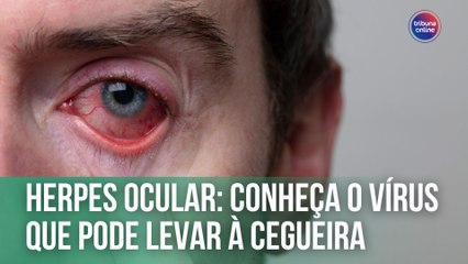 Herpes ocular: conheça o vírus que pode levar à cegueira | Fala, Doutora!