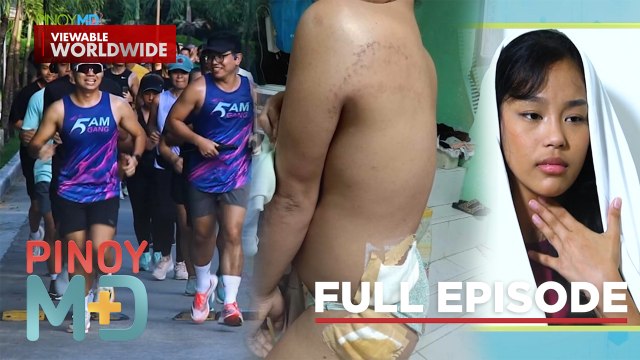 Aksidente sa apoy, rainy season illnesses at health benefits ng pagtakbo (Full Episode) | Pinoy MD