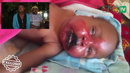 [#Exclusif] Gabon : Staline Moukanda nous parle de la maladie de son enfant