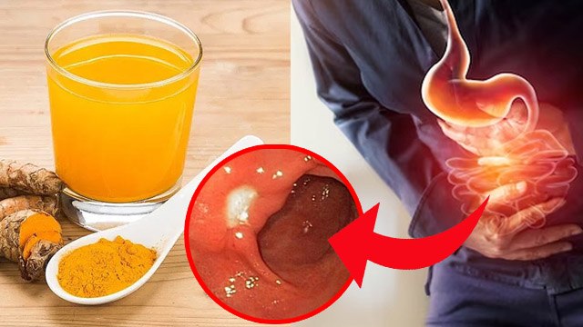 Garmi Me Khali Pet Haldi Pani Peene Se Kya Hota Hai |Turmeric Water In Summer Side Effects|Boldsky