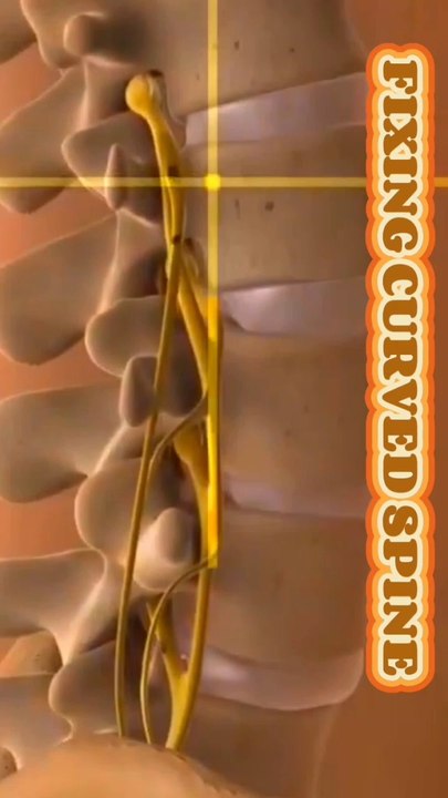 Spinal cord injury 3D animation shorts रीढ़ की हड्डी की चोट 3डी एनिमेशन शॉर्ट्स স্পাইনাল কর্ড ইনজুরি 3D অ্যানিমেশন শর্টস إصابة الحبل الشوكي شورت رسوم متحركة ثلاثي الأبعاد 1. "Spinal Cord Surgery Explained" 2. "Spine Surgery Animation" 3. "Spinal Injury Tr