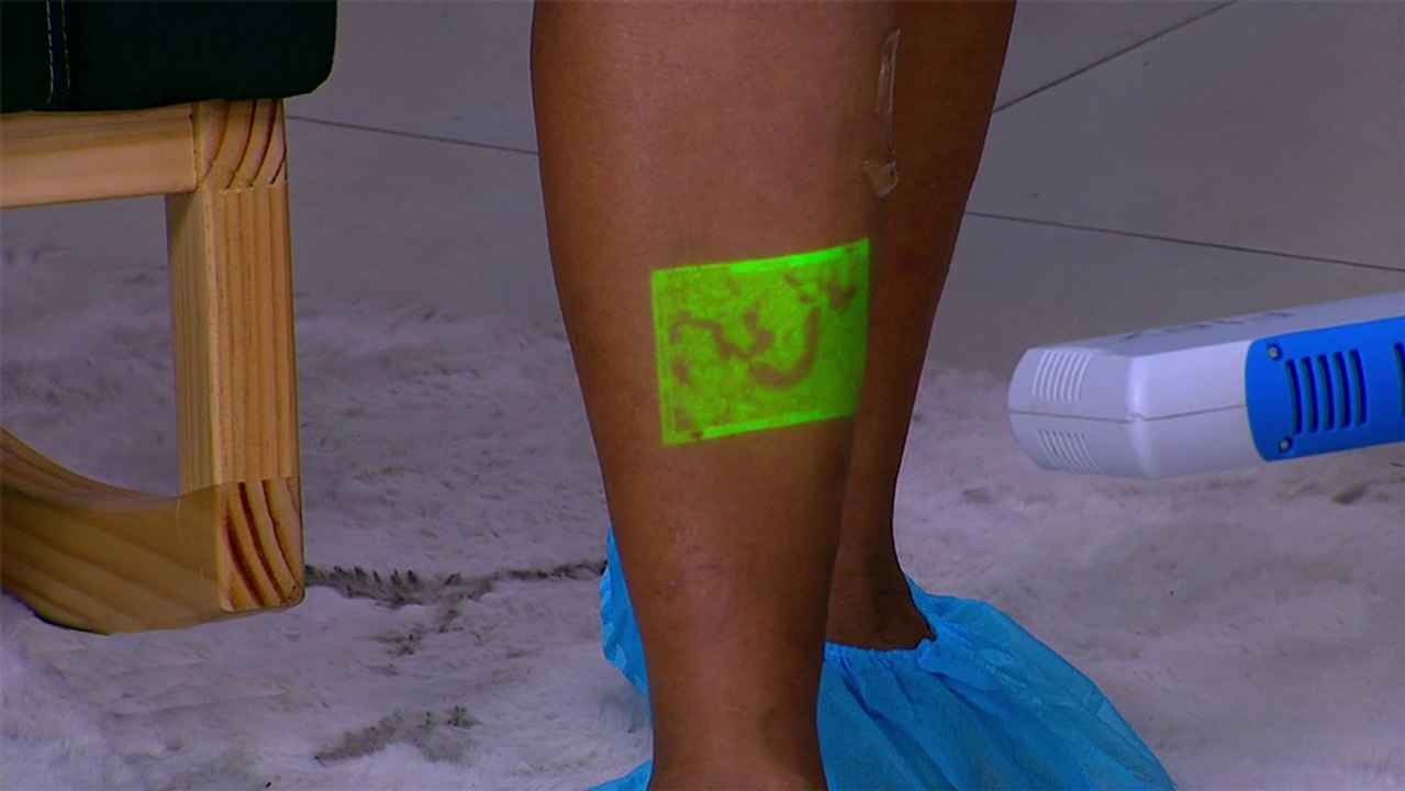 bd-mejore-su-salud-venosa-080724