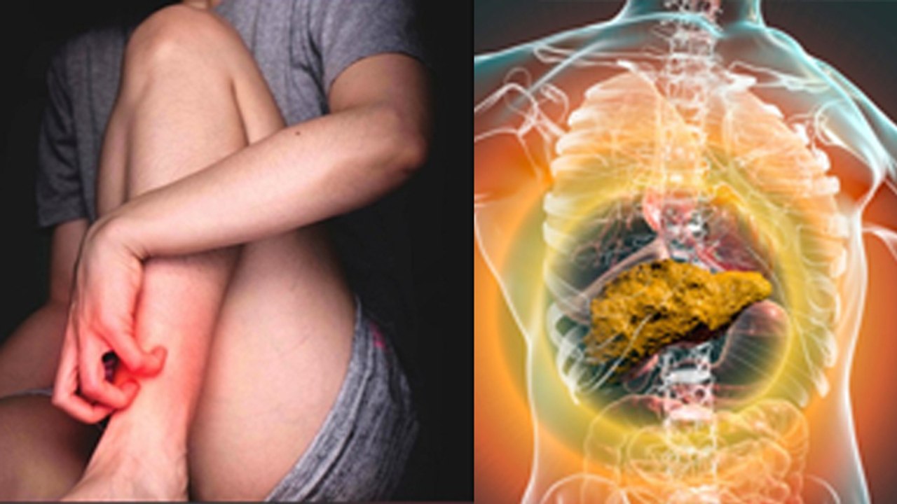 Leg Itching At Night Causes & Treatment: रात को सोते समय पैरों में खुजली क्यों होती है|Boldsky