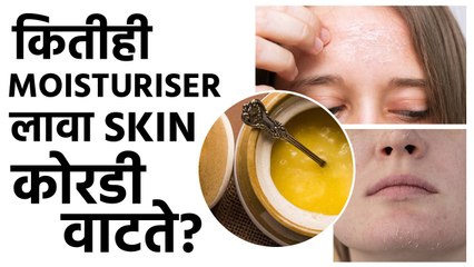 Download Video: प्रचंड Dry Skin साठी हे 5 उपाय नक्की Try करा | Effective Moisturizer For Dry Skin | Skincare  | MA2