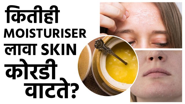 प्रचंड Dry Skin साठी हे 5 उपाय नक्की Try करा | Effective Moisturizer For Dry Skin | Skincare | MA2