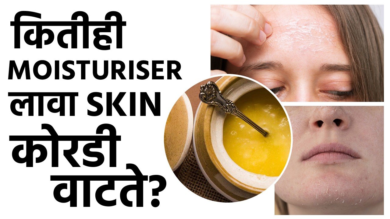 प्रचंड Dry Skin साठी हे 5 उपाय नक्की Try करा | Effective Moisturizer For Dry Skin | Skincare  | MA2