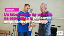 Un laboratorio de prótesis da esperanza a pacientes amputados en México