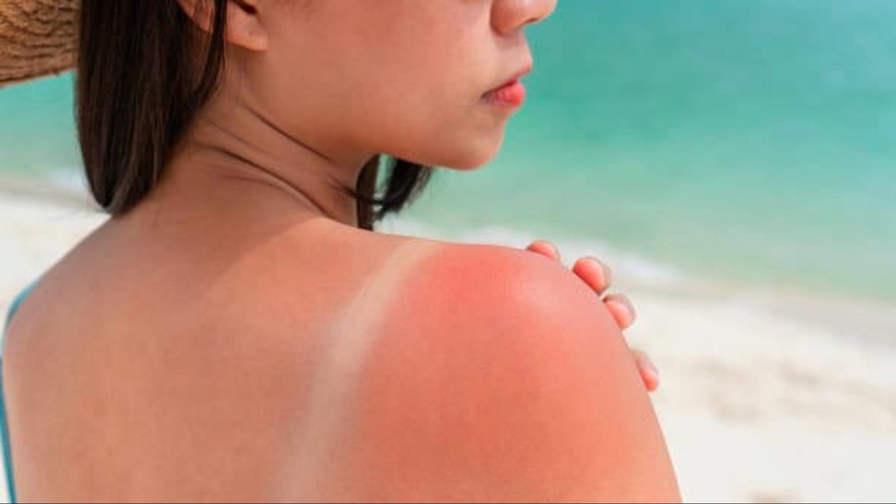 Índice UV: ¿Qué Es Y Cómo Protegerte Del Sol? (...