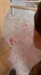  Images horribles de l'intérieur de l'Okhmatdyt, centre de santé infantile à Kiev,  qui a été touché par un missile russe.