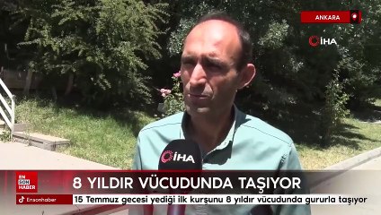 15 Temmuz gecesi Genelkurmay'da yediği ilk kurşunu 8 yıldır vücudunda gururla taşıyor