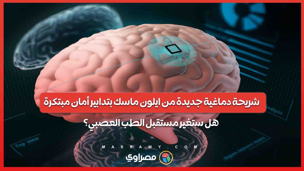 شريحة دماغية جديدة من ايلون ماسك بتدابير أمان مبتكرة... هل ستغير مستقبل الطب العصبي؟