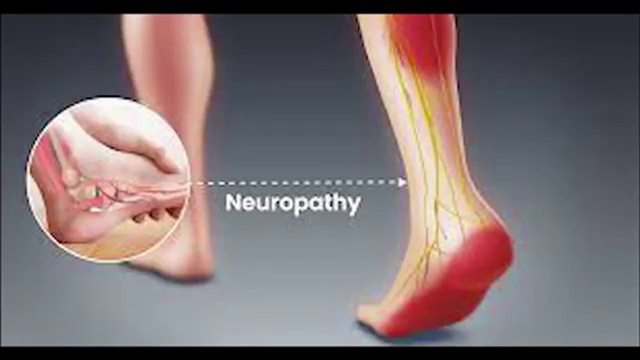 Nerve damage pain vitamin & foods اعصابی کمزوری سے نجات پائیں