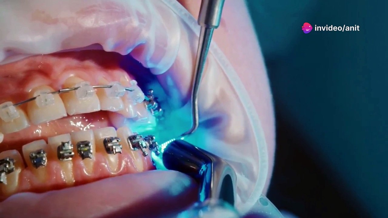 How to Get the Most Out of Your Orthodontic Treatment | Orthodontist in Plano