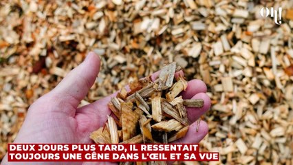 La vie de cet homme a tourné au cauchemar après avoir été piqué par une abeille à l'œil droit