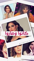 فاديا الطويل وتغيير جذري في ملامحها بعد عملية شد الوجه