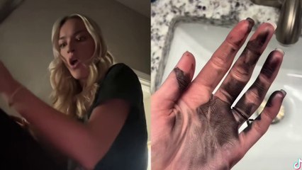 Woman SHOCKED when hair curler explodes - leaving her hand blackened