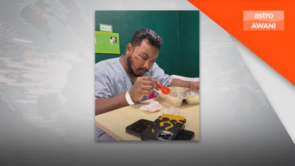 CEO Batu patah gigi, terima 20 jahitan di kepala kerana kemalangan