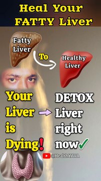 DETOX Fatty Liver Naturally by these effective drink | Fatty Liver Cure | #DetoxLiver