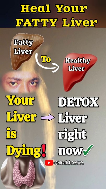 DETOX Fatty Liver Naturally by these effective drink | Fatty Liver Cure | #DetoxLiver