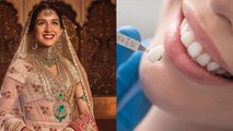 Anant Ambani Wedding: Radhika Merchant After Teeth Surgery Look Viral,Teeth Veneer Procedure,Cost...