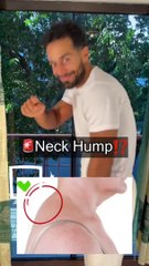 Reduce neck hump/ Reduce neck pain